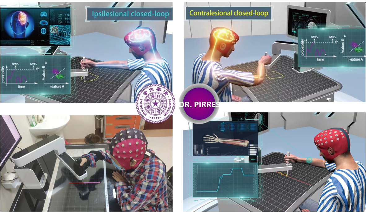 智能精準(zhǔn)康復(fù)機(jī)器人專家系統(tǒng)