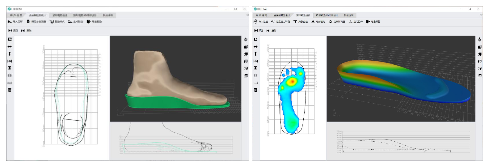 矯形鞋墊快速設計軟件